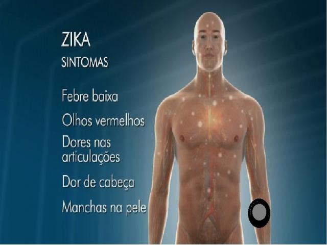 Sintomas Zika Vírus - Just Real Moms