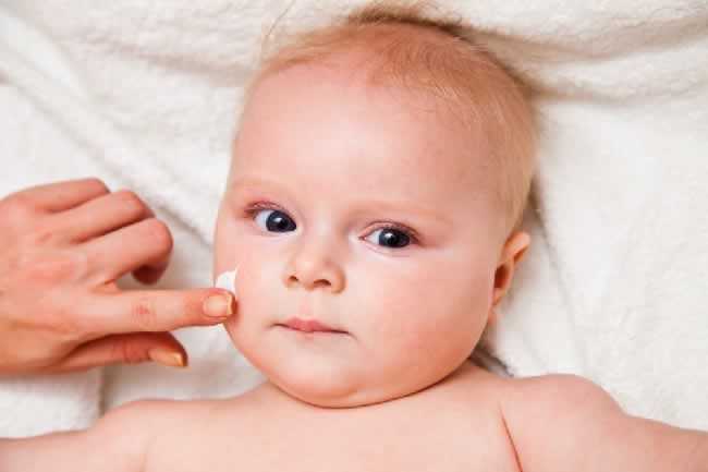 Você sabe o que é impetigo? – por Dra. Juliana Macéa