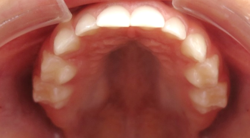 dentes 10