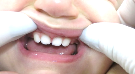 dentes 4