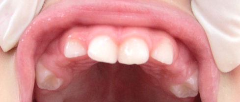dentes 6