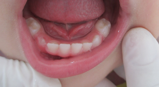 dentes 7