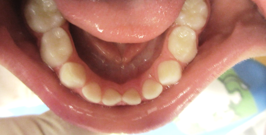 dentes 9