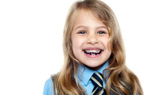 Quando colocar aparelho no dentes dos pequenos? - Por Dra. Paola Vidigal