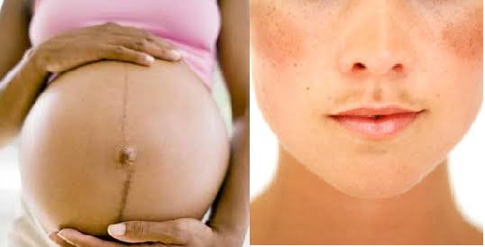 As mudanças na pele das gravidinhas e o que fazer com elas