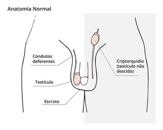 Just Real Moms Doenças Infantis Urologicas Dr Rafael Rocha Criptorquidia