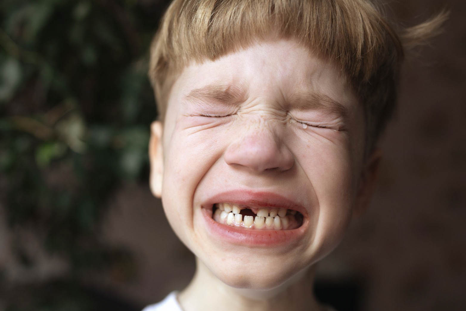 Prevenção de Traumas Dentários na Infância e Adolescência Clinica Coutinho Just Real Moms