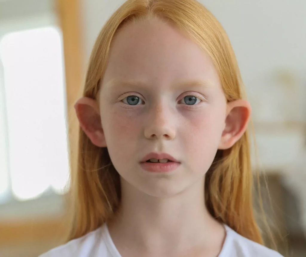 Otoplastia na infância orelha de abano Dra. Larissa Sumodjo Cirurgiã Plástica Just Real Moms